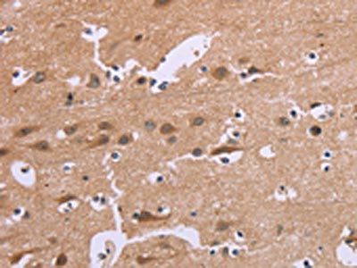 CDK1 Antibody