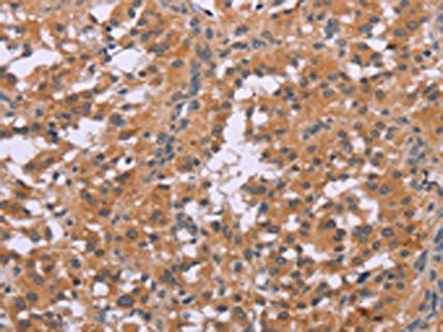 CDK1 Antibody