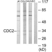 CDK1 Antibody