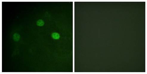 CDK1/CDC2 (Phospho-Thr14) Antibody