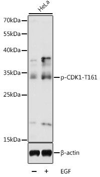 CDK1 (Phospho-T161) antibody