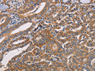 CDK11A/CDK11B Antibody