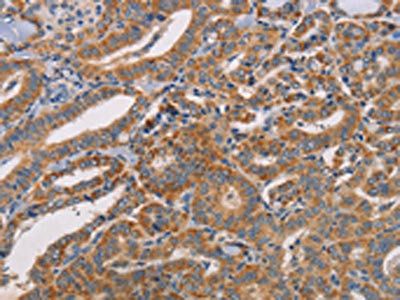 CDK11B antibody