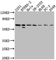 CDK17 antibody