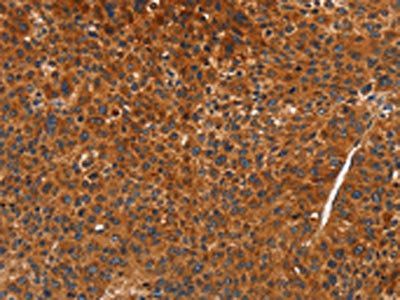 CDK19 Antibody