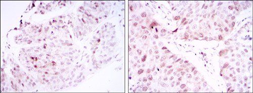 CDK1 Antibody