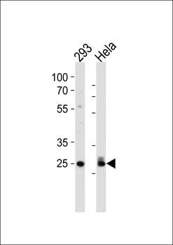 CDK2 (T14) antibody
