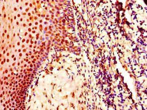 CDK2 Antibody