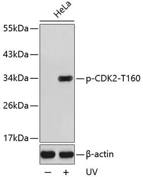 CDK2 (Phospho-T160) antibody