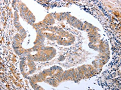 CDK20 Antibody