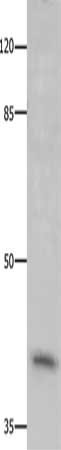 CDK20 Antibody
