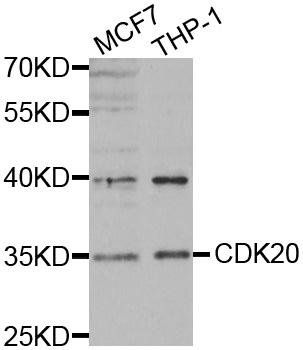 CDK20 antibody