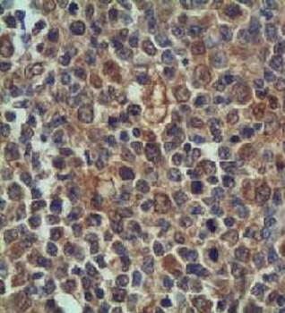 Cdk2 Rabbit Polyclonal Antibody