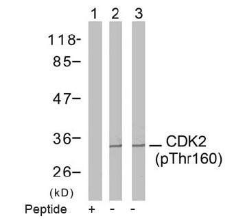 CDK2 (Phospho-Thr160) Antibody