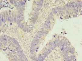 CDK5 Antibody