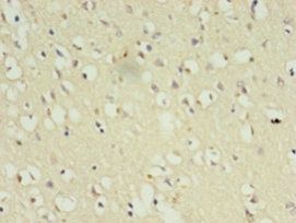 CDK5 Antibody