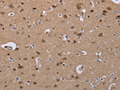 CDK5 Antibody