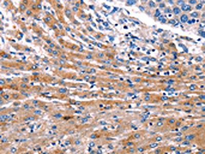 CDK5 Antibody