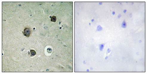 CDK5 (Ab-15) Antibody