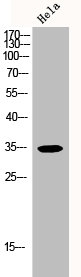 CDK5R1 antibody