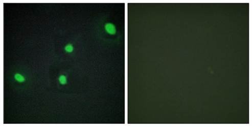 CDCA4 Antibody