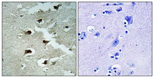 CDCA4 Antibody
