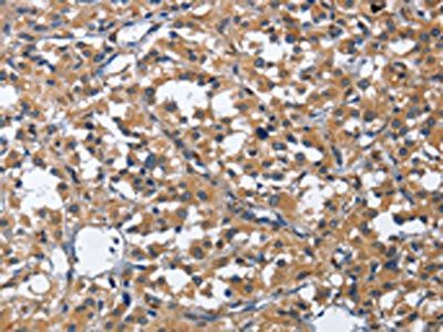 CDK5RAP3 Antibody