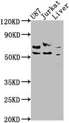 CDK5RAP3 Antibody