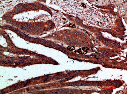 CDK6 Antibody