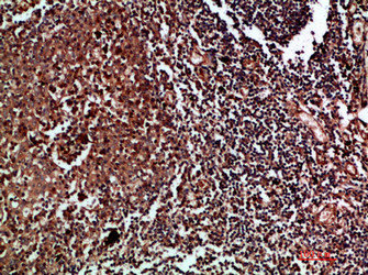 CDK6 Antibody