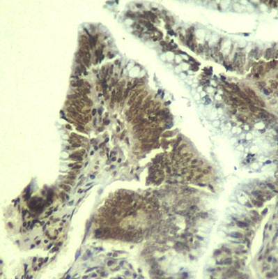 CDK6 (Ab3) Antibody