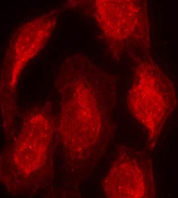 CDK6 (Ab3) Antibody