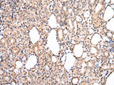 CDK8 Antibody