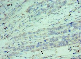 CDK9 Antibody