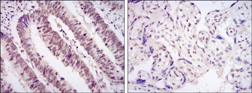 CDK9 Antibody