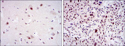 CDK9 Antibody