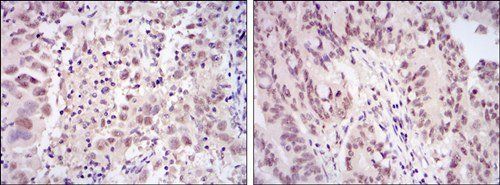 CDK9 Antibody