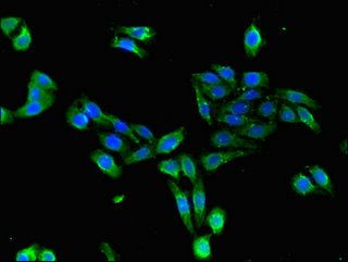 CDKAL1 Antibody