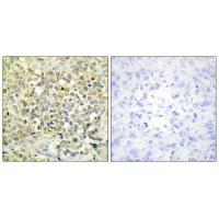 CDKL4 Antibody