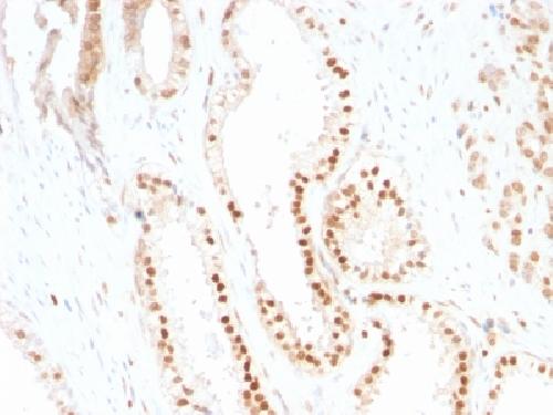 p27Kip1 (Mitotic Inhibitor/Suppressor Protein) Antibody