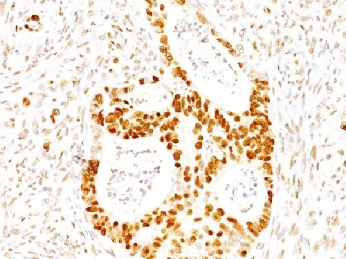 p27Kip1 (Mitotic Inhibitor/Suppressor Protein) Antibody