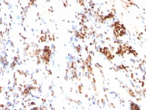 p27Kip1 (Mitotic Inhibitor/Suppressor Protein) Antibody