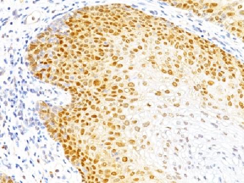 p27Kip1 (Mitotic Inhibitor/Suppressor Protein) Antibody