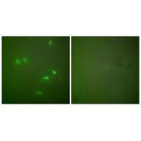 CDKN2A Antibody