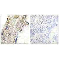 CDKN2A antibody