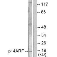 CDKN2A antibody