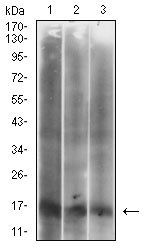 CDKN2A Antibody