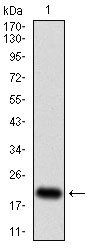 CDKN2A Antibody