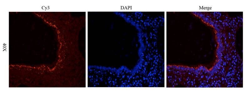 CDKN2A antibody