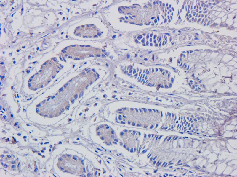 CDKN2A antibody
